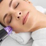 Women Receiving Morpheus8 Treatment in Dallas, GA